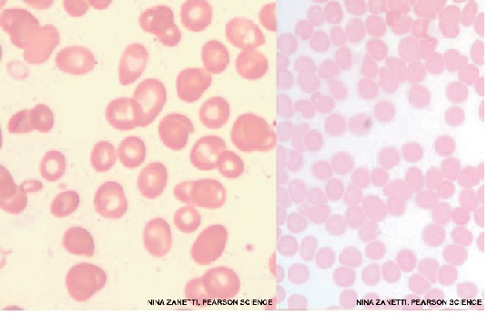 2353_A normal blood smear.jpg